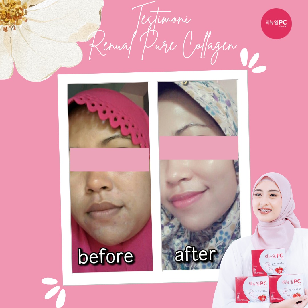 Kartu resmi before after: noda mereda, kulit lebih rata