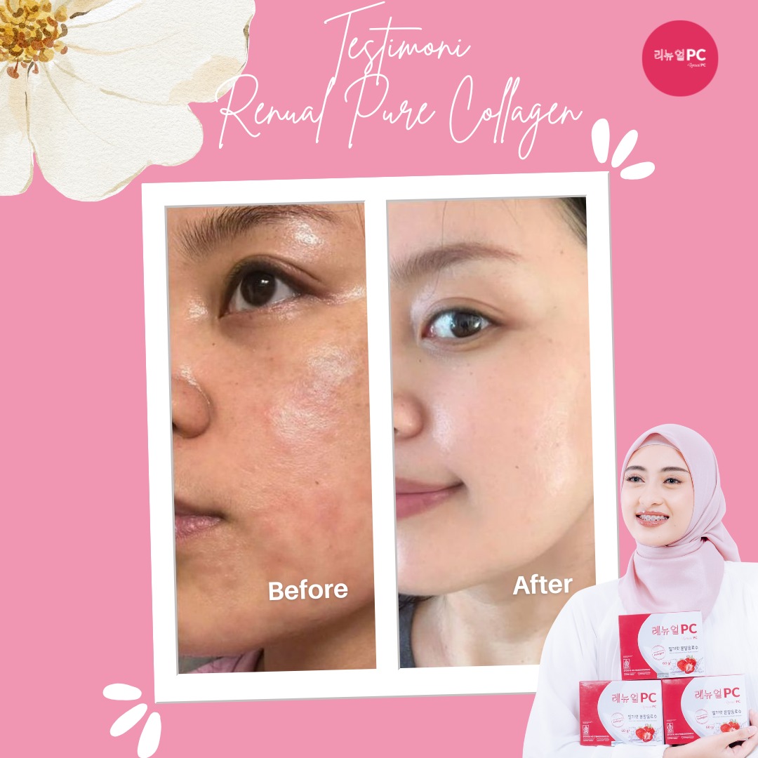 Kartu resmi before after: tekstur pipi lebih halus